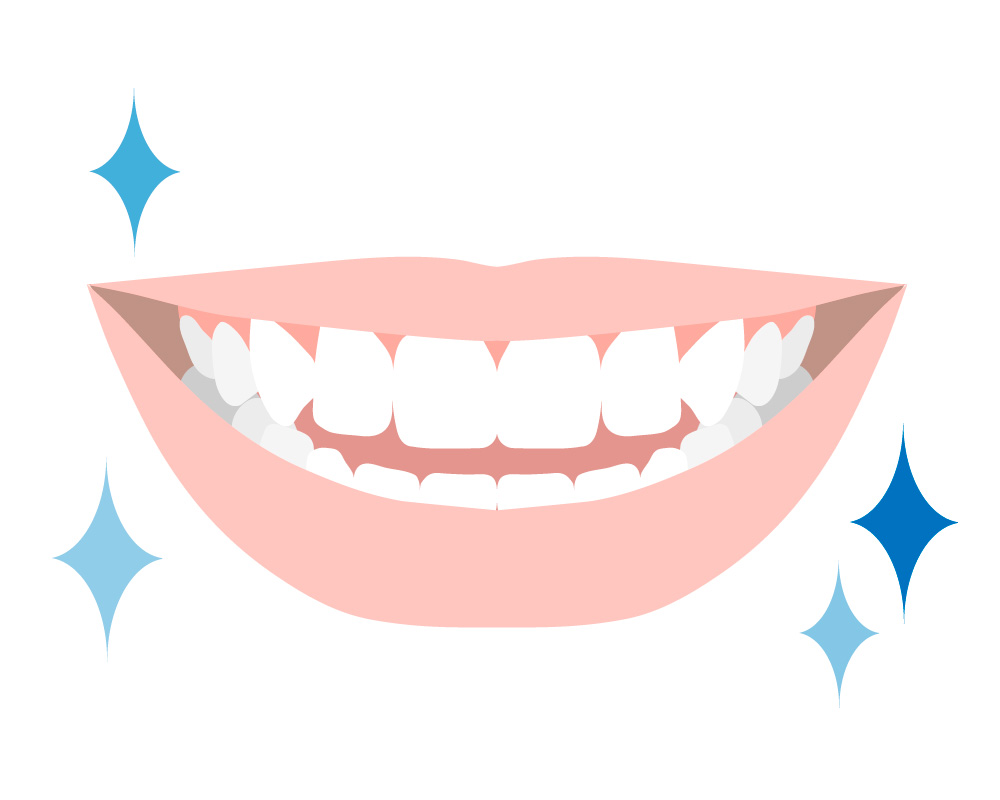 白すぎる歯は逆に不自然？