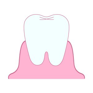 歯科医師監修山梨県甲府市ホワイトニング専門店虫歯予防歯周病予防歯を白くする