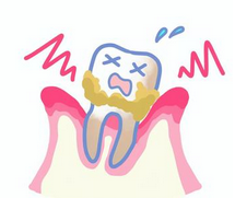 【やっぱり怖い！】虫歯や歯周病がもたらす健康被害ð¦