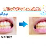 女性Hさん（匿名）