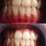 ビューティースマイル使用実例３