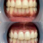 ビューティースマイル使用実例５