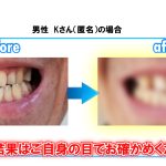 男性　Kさん（匿名）