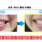 女性　Wさん（匿名）の場合