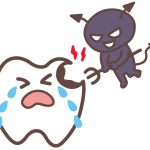 知っておこう!虫歯の進行レベル4段階!