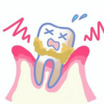 【やっぱり怖い!】虫歯や歯周病がもたらす健康被害💦