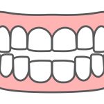 噛み合わせのセルフチェック！