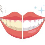 ホワイトニングの意外な効果とは！？