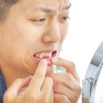 ホワイトニングの頻度について