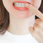 ホワイトニングをしないでいるとどうなる？